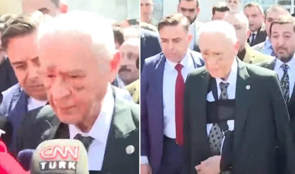 Devlet Bahçeli oy kullandı: Yüzündeki morluklar dikkat çekti!