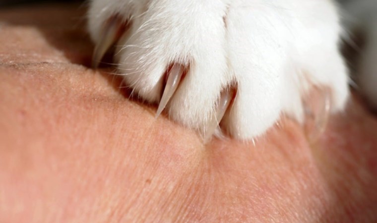 Uzmanı uyardı: ‘Kedi tırmığı’ hastalığı her yıl giderek artıyor
