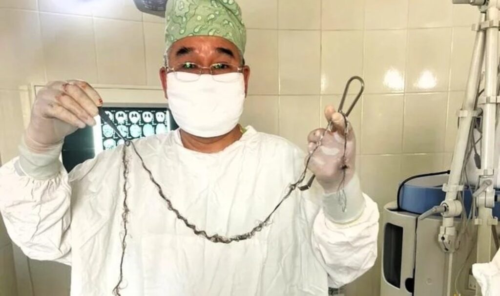 Ameliyatla beyinden çıkarıldı: Metrelerce uzunluğunda