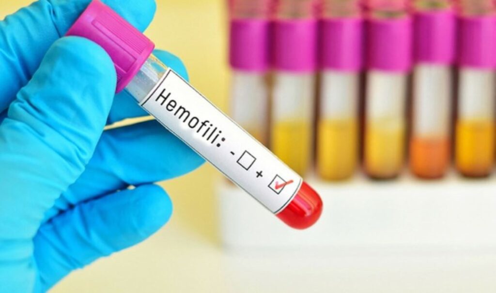Hemofili nedir? Hemofili belirtileri neler?