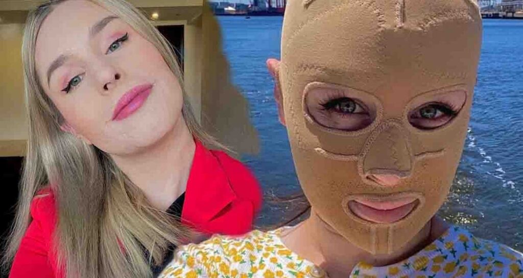 Hayatı saniyeler içinde değişti: Artık sürekli maske takmak zorunda