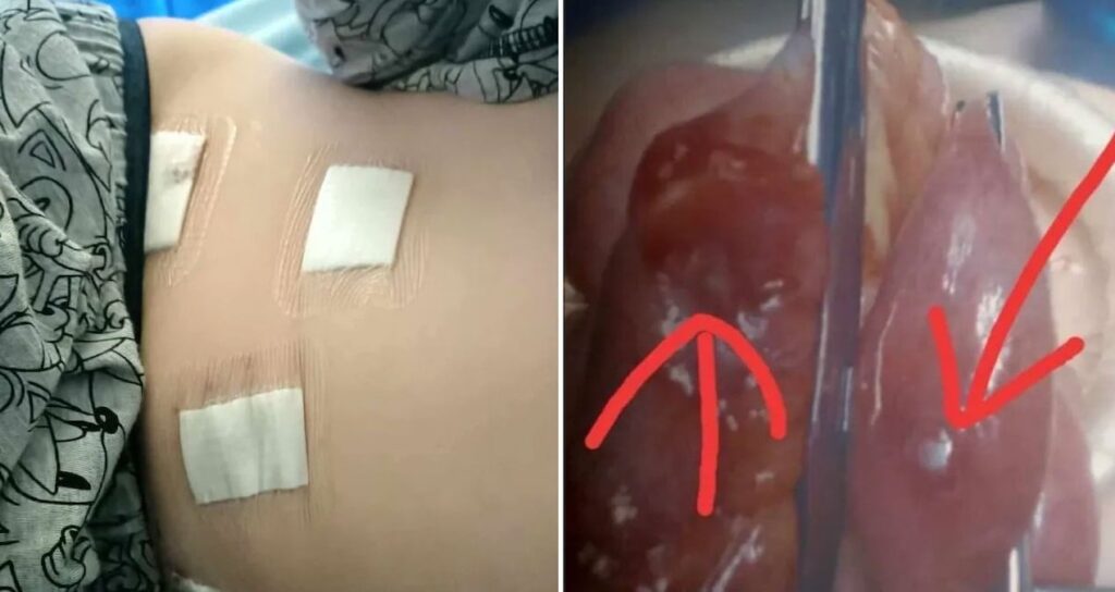 TikTok akımı can alıyordu: 12 yaşındaki çocuk son anda kurtuldu