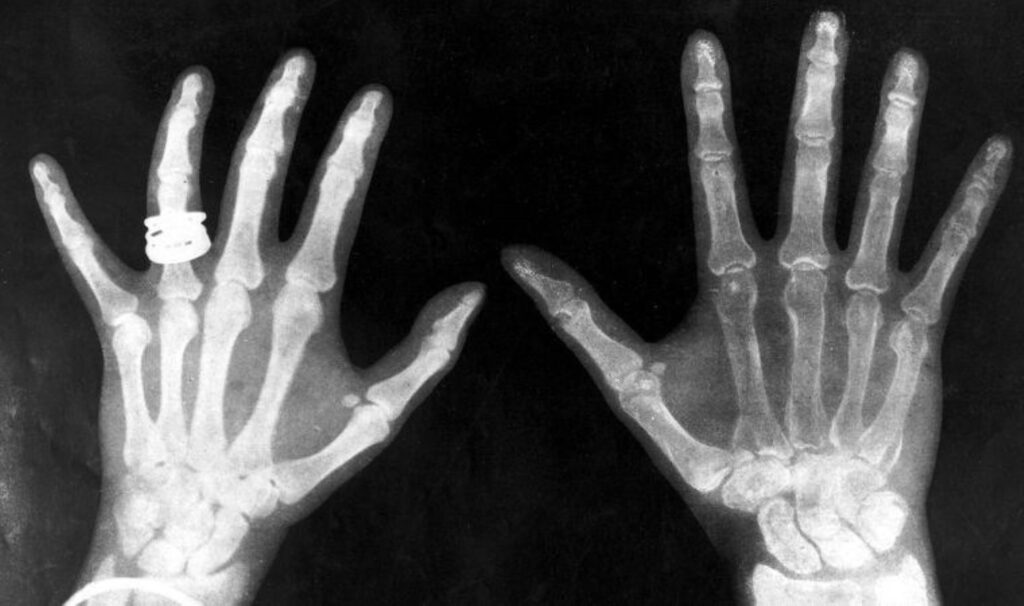 Yeni çip akıllı telefonları X-ray cihazı yapabilecek