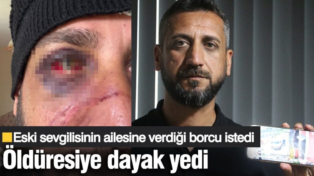 Eski sevgilisinin ailesine verdiği borç parayı isteyince dayak yedi