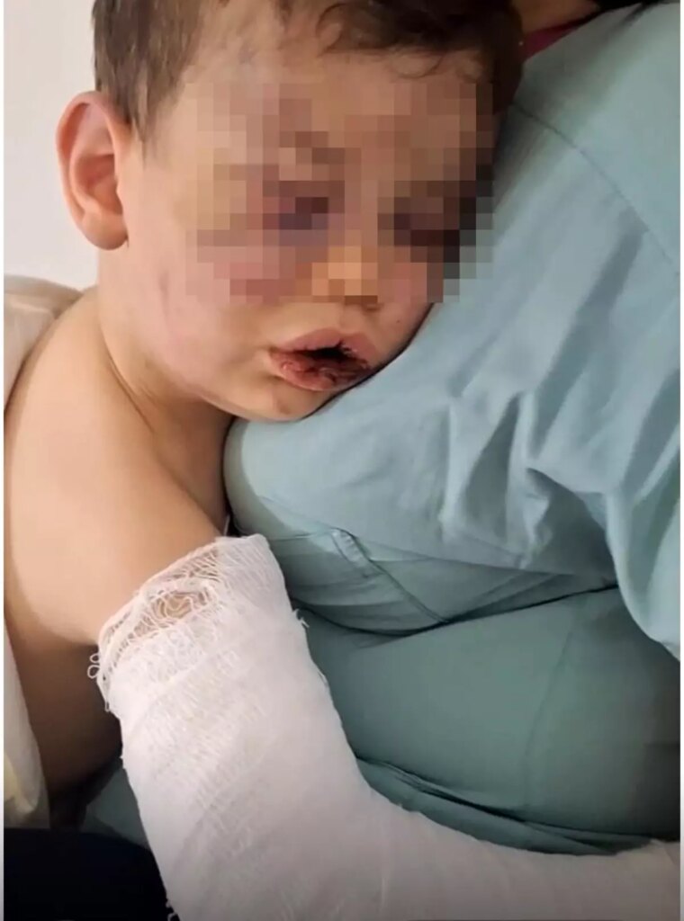 2 Yaşındaki Çocuk Devlet Korumasında