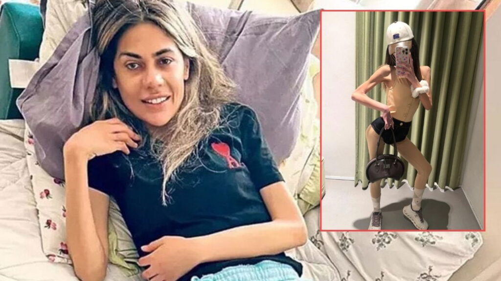Cezaevinden 37 kilo ile çıkmıştı: Nihal Candan’ın son hali görenleri korkuttu!
