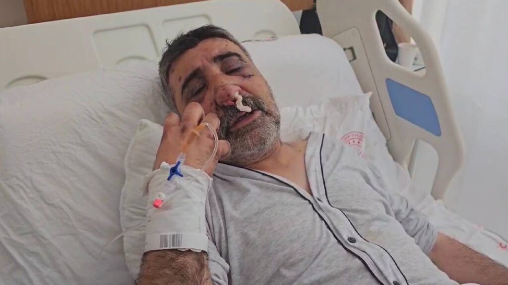 İngiliz boksörün darbettiği taksici konuştu: Isırmaya öpmeye başladı, elini gözüme sokmaya, yırtmaya çalıştı