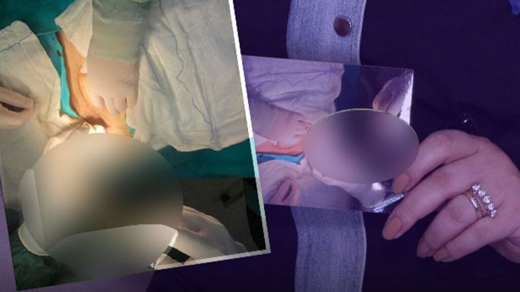 Doktordan skandal sözler! Sezaryen doğumla hayatı kabusa döndü!