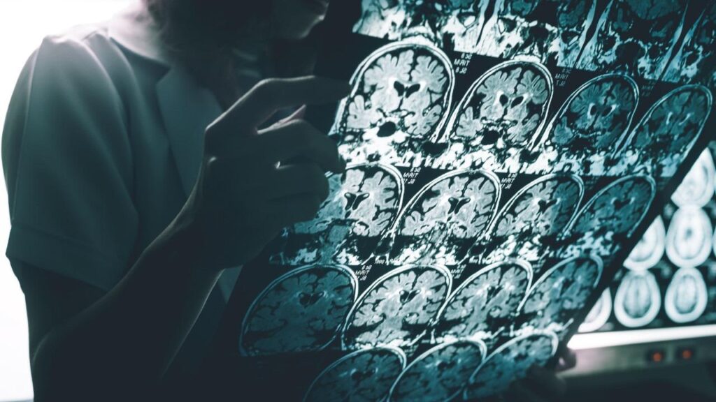 Harvard’dan çığır açan buluş: Alzheimer’a karşı lityum umudu
