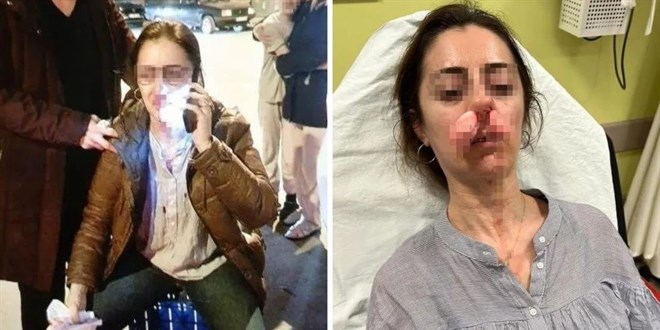 Otomobil kapısı ‘Silah’ sayıldı: Kıskançlık krizinde masum kadın yaralandı