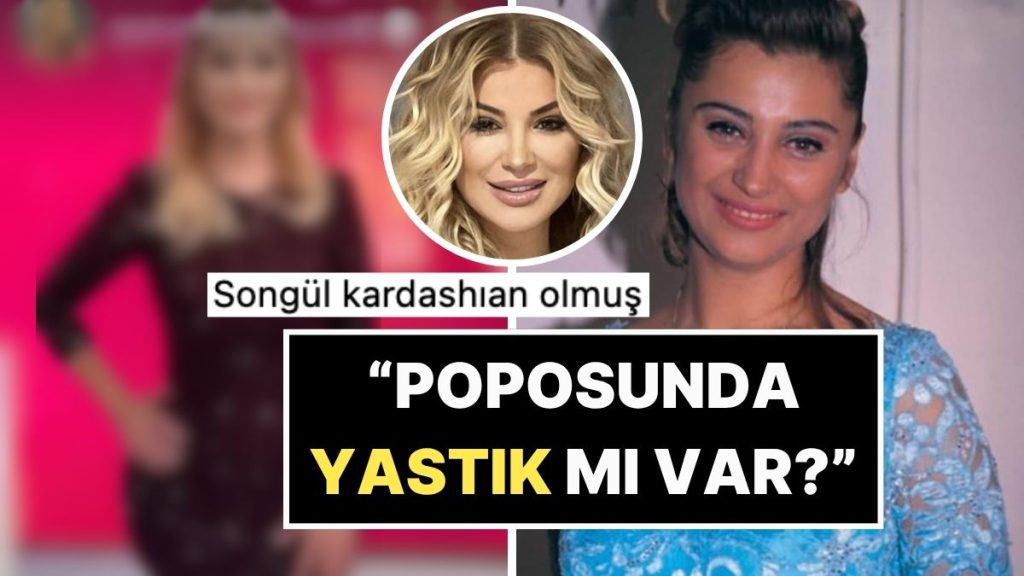 Estetiğe Doymuyor: Poposunu Yaptıran Songül Karlı’nın Son Hali Dillere Fena Düştü!