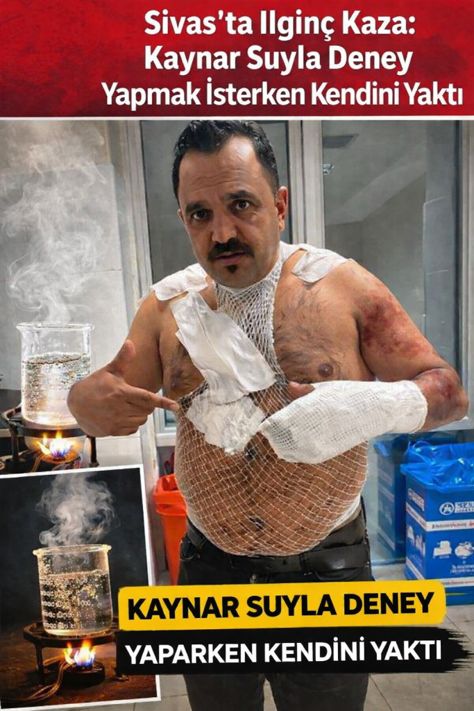 Sivas’ta İlginç Kaza: Kaynar Suyla Deney Yapmak İsterken Kendini Yaktı